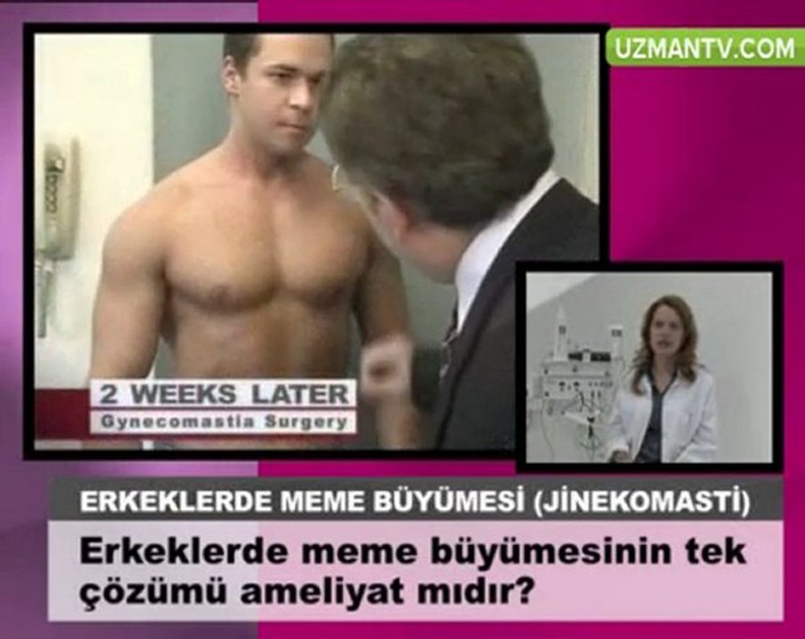 Erkeklerde meme buyumesinin tek cozumu ameliyat midir