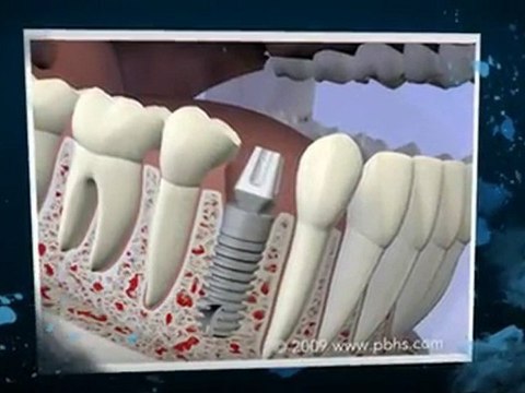 Dental Colorado Springs - You've Found Your New Dental Home