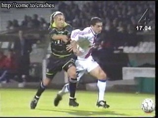 futbolcunun ayağı nasıl kırıldı