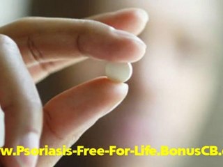 What Does Psoriasis Look Like - Psoriasis On Scalp