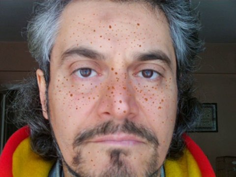 matillaatasever- FRECKLED ATiLLA