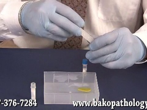 Biopsy Fixation, Rinse and Transfer - Bako Podiatric Patholo