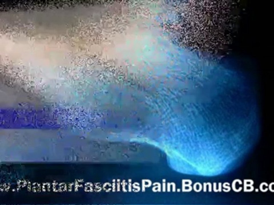 Plantar Fasciitis Relief - Plantar Fasciitis Pain