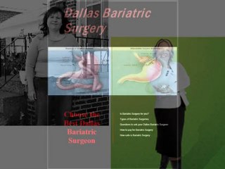 dallas bariatric surgery-bariatric surgery dallas-bariatric
