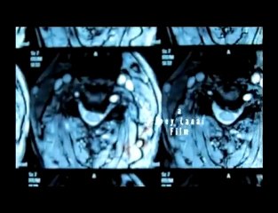 Producer, director, writer & actor Joey Lanai on EOE