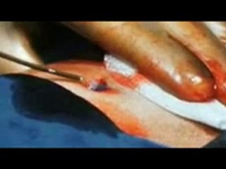 2-5 les grandes heures de la médecine[3è partie]