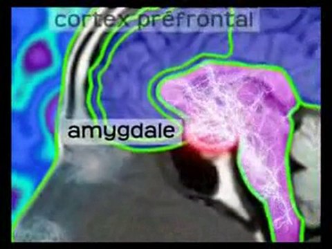 Guérir Autrement - Dr David Servan-Schreiber 4/4