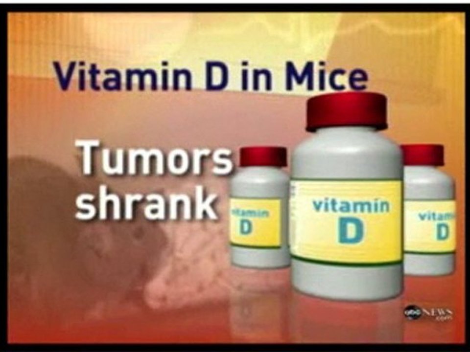 Breast Cancer Info-Vitamin D **SHRINKS** Breast Cancer Cells