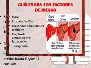 Varices treatment in Mexico,Cancun Tijuana at affordabl Cost