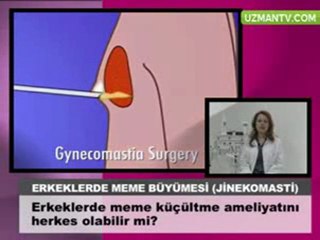 meme kucultme ameliyatini herkes olabilir mi - Op Dr Eser Aydogdu