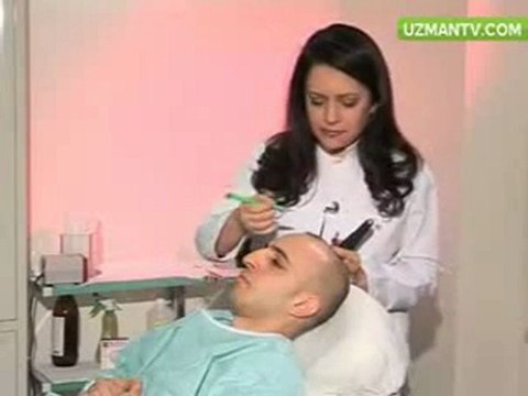 SAÇ EKİMİ NASIL YAPILIR - OP DR ESER AYDOGDU