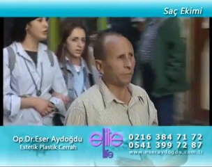 Saç Ekimi - Op.Dr.Eser Aydoğdu