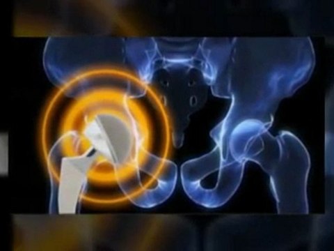 Hip Lawyer Protecting Your Rights