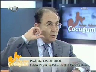 Kepçe Kulak Ameliyatı Artık Çok Kolay