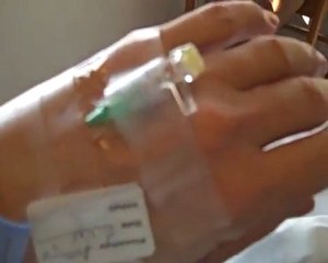 Ouch!!! Total Knee Replacement - A Visual Diary