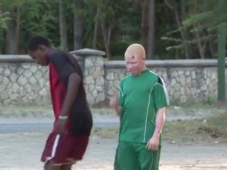Des albinos créent une équipe de football en Tanzanie