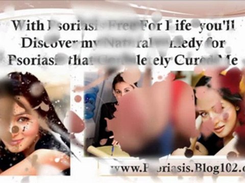 psoriasis treatment natural - psoriasis natural remedies - psoriasis cures