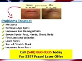 Laser Skin Rejuvenation Vienna Va|$397 Cosmetic Laser