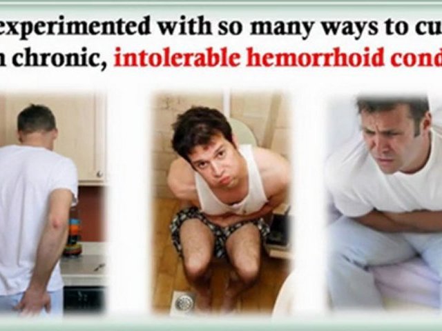 treatment for external hemorrhoids – bleeding hemorrhoids treatment