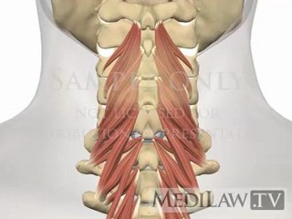 Cervical Spine Muscles Multifidus chiropractry multimedia