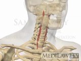 Cervical Spine Muscles Deep Flexor Longus Capitus Colli chiropractor animations