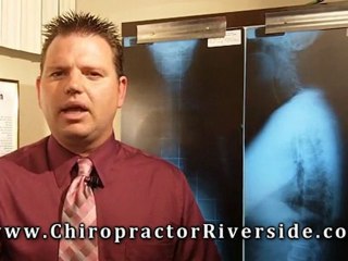 Chiropractic adjustment Riverside CA Moreno Valley CA Corona