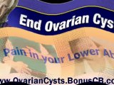 Ovarian Cysts Cure - Ovarian Cyst Treatment - Polycystic Ov