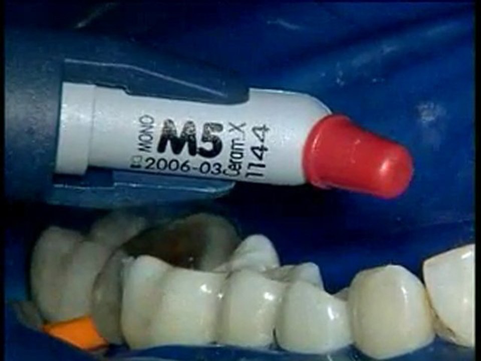 CeramX Mono de Dentply