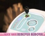 Permanent laser hair removal, Rio Scanning Laser 2/2