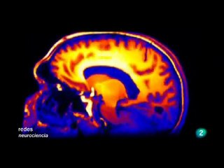 Ejercicio y plasticidad cerebral (BDNF): David Costa