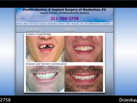 Manhattan, New York Cosmetic Dentist – Dr. Zev Kaufman