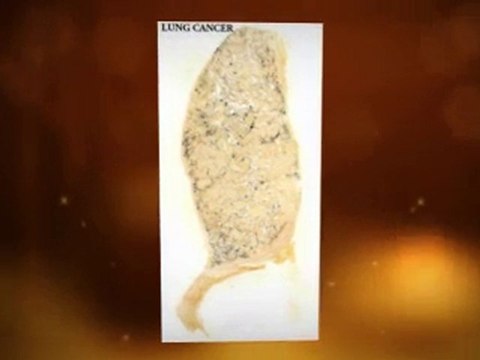 Asbestos Exposure Jersey NJ