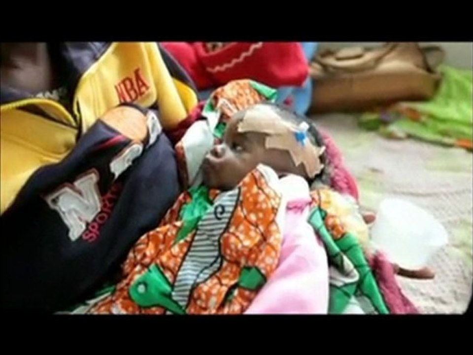 Mt. Meru Hospital Doctor Nurse Exchange Program