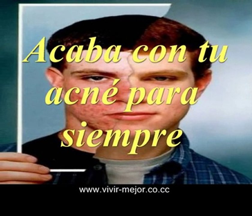 (sin granos en la cara) http://vivir-mejor.co.cc