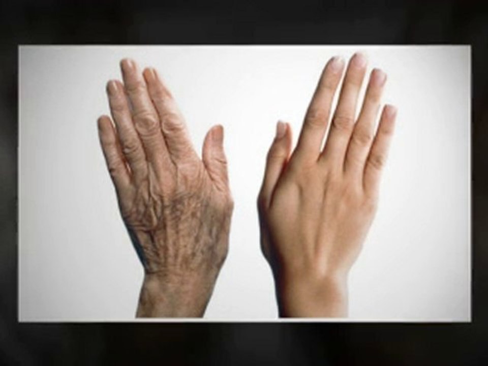 Stop Those Wrinkles Now