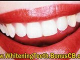 Whitening Teeth Tutorial - Whitening Teeth Review