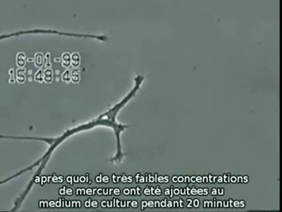 SANTE : effets du mercure sur les neurones.