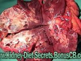 kidney diet for humans - kidney diet secrets review - renal