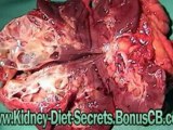 kidney diet foods - renal diet recipes - beef kidney recipe