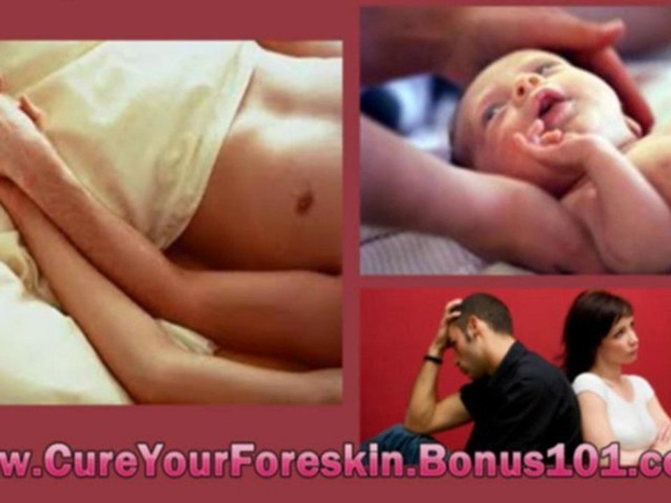 how to cure phimosis - foreskin and diabetes - dry foreskin