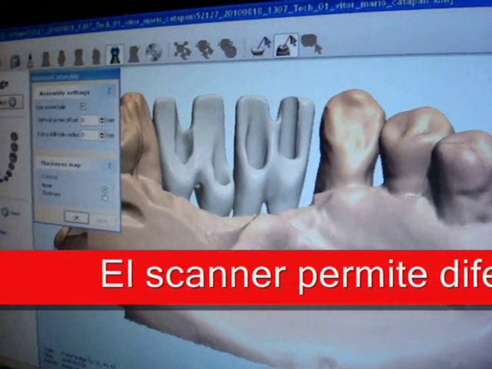 ilapeo implantes dentales cursos capacitacion