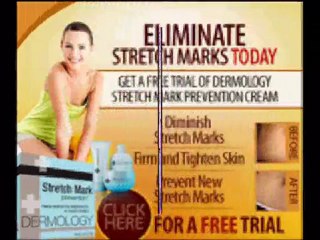 How to get rid of stretch marks