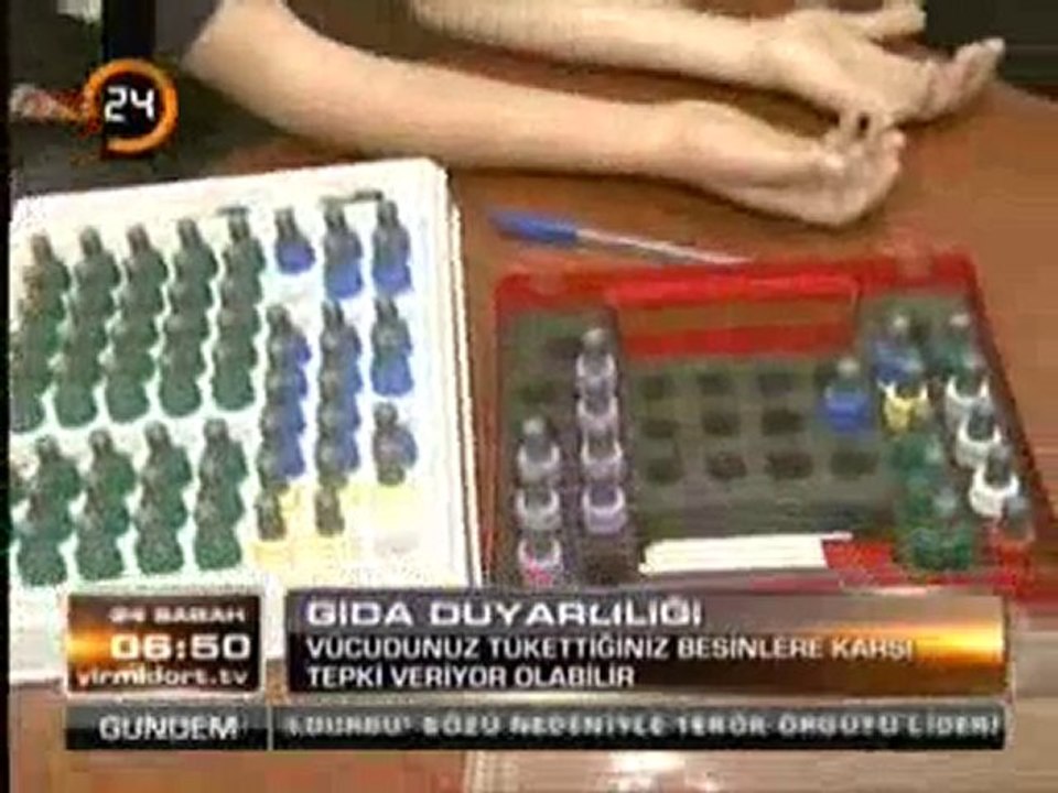 Alerji Uzmanı Dr. Emin Özkaya Gıda Duyarlılığını anlatıyor