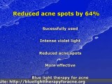 Does using Blue Light Therapy Cure Acne?