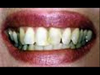 ORAL HYGIENE-Bellevue,WA.