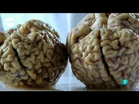 ¿Somos tan diferentes?: Cerebro, hormonas y genetica