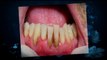 Cosmetic Dentistry Richmond VA| Implant Dentist Richmond VA