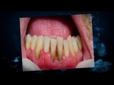 Cosmetic Dentistry Richmond VA| Implant Dentist Richmond VA