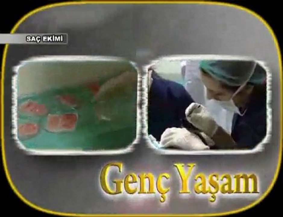 Genç Yaşam Programı Saç ekimi ile ilgili merak edilenler