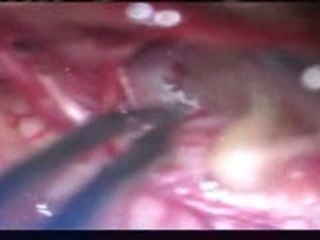 PORK MAKES WORMS GROW IN YOUR BRAIN!!